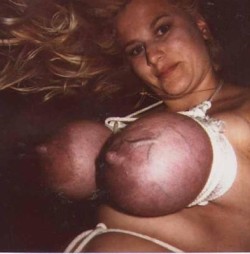tightandpurple:  Tied tight deep purple tits with bulging veins,