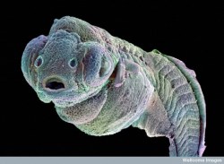 currentsinbiology:    Wellcome Image of the Month: Zebrafish Embryo