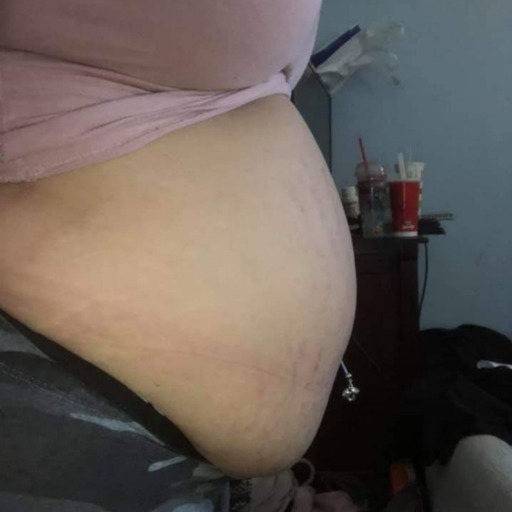 dsbelly86:I really swelled up like a blimp, didn’t I?!Think
