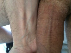 Pic submitted by: mrgirthA test for you to start your day. Which is the mans wrist, and which is his enormously THICK, cunt stretching monster cock?