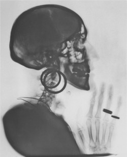divinedisease:      Negative of X-Ray of Meret Oppenheim’s