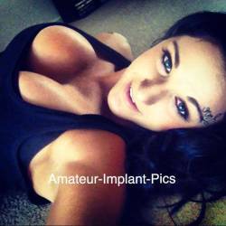 amateur-implant-pics:  elise bailey  Her seeing them for the