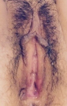 cocknballstory:  Close ups of my wifes juicy cunt some with bush