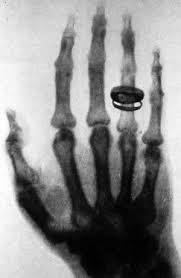 sixpenceee:  First Human X-ray 1896. The woman, Marie Curie,