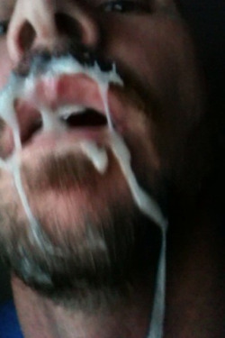 Beardburnme