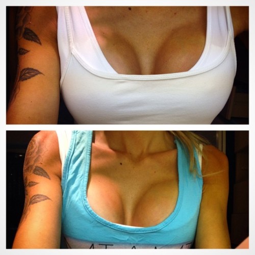 amateur-implant-pics:  amberdack