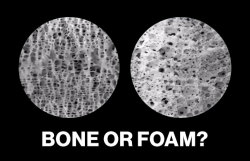 corporisfabrica:  ted:  One of these photos is of bone, the other