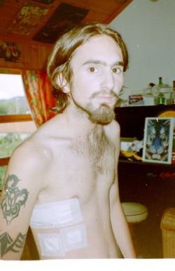 found this old photo from after my operation…. Can`t believe