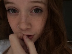 los-gringo:  cosettee:i have so many freckles   I’m so in
