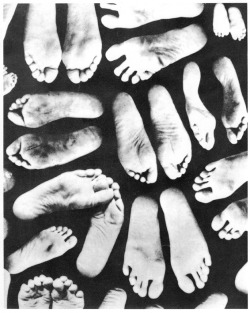 retroreverbs:  Suppose we look at the feet of children in our