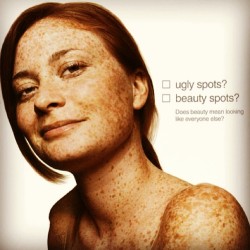 #ginger #freckles #red #gingerlover #major #coverage #beautymarksforsure