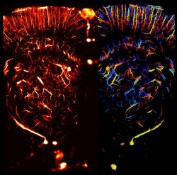 txchnologist:  Ultrasound Goes Microscopic to Image Living Organs