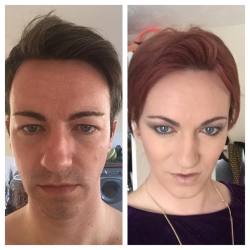 leicester-sissy:  HRT day 1 and Month 9 time just goes so fast.