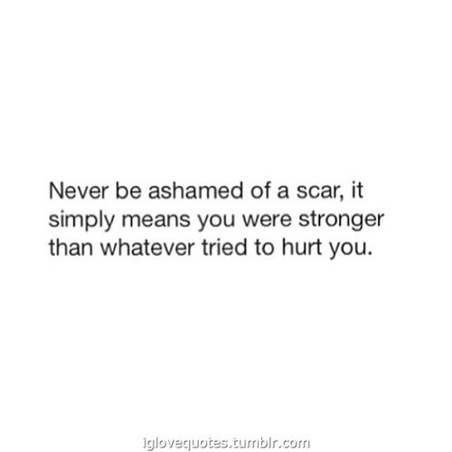 iglovequotes:  Daily dose of love quotes here