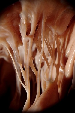 Heart strings; the chordae tendenae