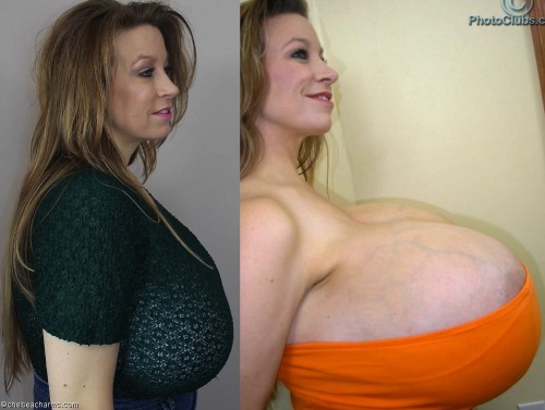 boobjobaddict:  Look at how noticeably more happy she looks when shes that much bigger. Get some huge fuckbags installed and you too will know this joy! 