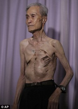 sixpenceee:  Atomic Bomb Survivor: Sumitery Taniguchi The frail