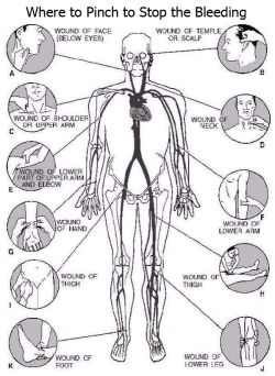 1000-life-hacks:  This diagram could save someone’s life! 