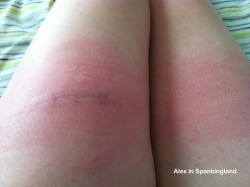 I love/hate having the front of my thighs caned. Pure. Agony.