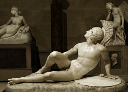 hadrian6:  The Wounded Achilles. 1825. Filippo Albacini. Italian