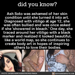 did-you-kno:Ash Soto was ashamed of her skin  condition until
