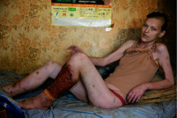 hogpig:  “Poltava, Ukraine. Tanya, 29, a sex-worker and drug