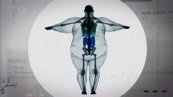 yoshimuraspeed:  Twitter / tansetype4: 体重180キロ男性を透かすとこんな感じらしい。興味深い。