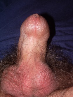 blindmeat:  I love this cock.  Totally unretractable foreskin,