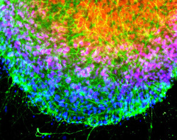 frontal-cortex:  Microscopy of chicken cells using nano-crystals