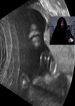 dorkly:  Emperor Palpatine Ultrasound Release your anger! Also