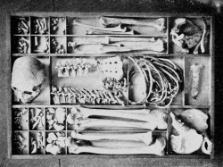  Entire human skeleton in a box. 