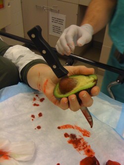 elondra:  THIS HAS ALMOST HAPPENED TO ME WHILE CUTTING AN AVOCADO