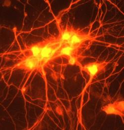neurosciencestuff:  Scientists identify main component of brain
