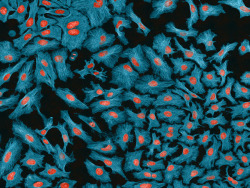 ucsdhealthsciences:  HeLa cells, false-colored. Image courtesy