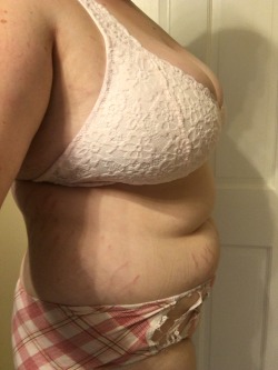 donuuuuuts:  A before and after of my water bloat (yes it’s