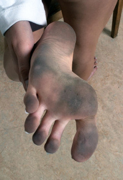 Foot Fetish Candy