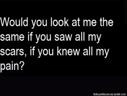 beingaselfharmer:  I doubt that..