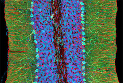 medicalschool:  Fluorescence image of a rat cerebellum stained