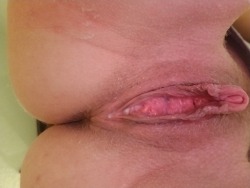 fatgreedypussy:  My meaty slit  Huge clit, big lips, long meaty,