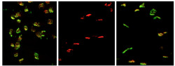 neurosciencestuff:  Image caption: MMP-9 controls onset of paralysis