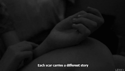 lonelinesstwinkle:  each scar … | via Tumblr pe We Heart It.
