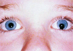 likeafieldmouse:  “Coloboma is a hole in one of the structures