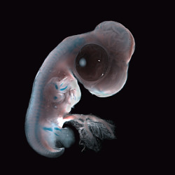 house-of-gnar:  Fluorescent Embryos  [Image 1] Chick ectopic