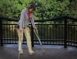 Girl in double long leg walking cast and crutches outdoorsDLLC