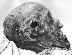 ankolie:  The cranium of the Swedish king Charles XII from an