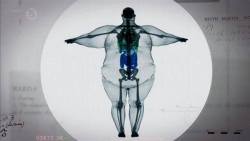 th3artofnursing:  An x-ray of a obese man.