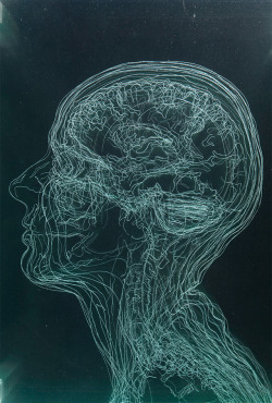 showslow:  Layered MRI Self-Portraits Engraved in Glass Sheets