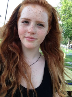 gelogenic-ginger:  I went outside and my freckles multiplied.