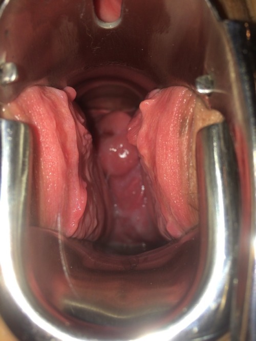 alexisfistingfeen:  Hubby came home, speculum fun from the front! Look at that cervix 