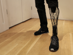 sculptores:William Root - Exo (3-D printed prosthetics)